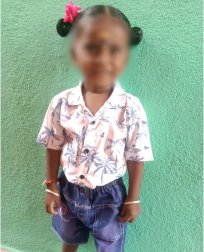Help 2-Year-Old Nilan Undergo Urgent Open-Heart Surgery